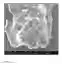 Fig. 02 - Process For Generating Nanometer Sized Particles That Increase Oxygen Levels In Mammalian Tissues