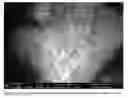 Fig. 07 - Process For Generating Nanometer Sized Particles That Increase Oxygen Levels In Mammalian Tissues