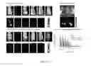 Fig. 07 - Photodynamic therapy composition