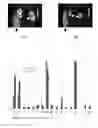 Fig. 02 - RENAL IMAGING AGENT