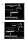 Fig. 01 - Targeting immunotherapy for amyloidosis