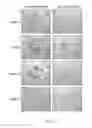 Fig. 08 - Targeting immunotherapy for amyloidosis