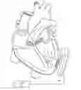 Fig. 01 - Crenellated inflow cannula