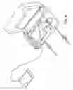 Fig. 09 - Apparatus for performing peritoneal ultrafiltration