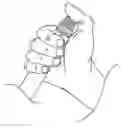 Fig. 01 - Auto-injector systems and method for delivering cyst medication on demand