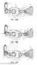Fig. 07 - COUPLING AND SUPPORTING OF APPARATUS ON THE FACE AND NECK