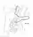 Fig. 02 - Gas without vent for patient interface