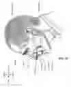 Fig. 09 - Gas without vent for patient interface