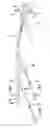 Fig. 01 - Method and apparatus for intra-aortic substance delivery to a branch vessel