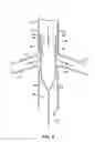 Fig. 04 - Method and apparatus for intra-aortic substance delivery to a branch vessel