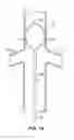 Fig. 13 - Method and apparatus for intra-aortic substance delivery to a branch vessel