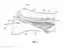 Fig. 02 - Methods for treating a tibial nerve-related condition