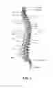 Fig. 04 - SPINAL CORD STIMULATION LEADS WITH CENTRALLY-CONCENTRATED CONTACTS, AND ASSOCIATED SYSTEMS AND METHODS