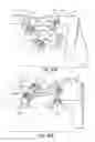 Fig. 11 - Stair climbing apparatus and method