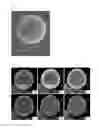 Fig. 02 - Metal particles having intermetallic compound nano-composite structure crystal