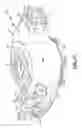 Fig. 07 - Spring aid assembly for a vehicle suspension system
