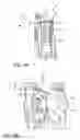 Fig. 09 - Series of mounting supports and mounting support for fastening radiator modules, and method for manufacturing mounting supports