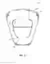 Fig. 02 - Airbag cover weakening patterns and related systems and methods