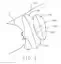 Fig. 02 - Airbag module