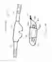 Fig. 07 - HEAD RESTRAINT APPARATUS WITH EXPANDABLE SEAT SECURING MECHANISMS