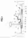 Fig. 02 - Power steering device