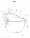 Fig. 02 - Airtight container having deformable cover unit or deformable container unit