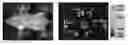 Fig. 01 - PSMA TARGETED FLUORESCENT AGENTS FOR IMAGE GUIDED SURGERY