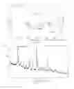 Fig. 53 - Solid forms of (1S,4S)-4-(2-(((3S,4R)-3-fluorotetrahydro-2H-pyran-4-yl)amino)-8-((2,4,6-trichlorophenyl)amino)-9H-purin-9-yl)-1-methylcyclohexane-1-carboxamide and methods of their use