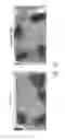 Fig. 06 - Animal model of longevity and related methods for increasing longevity and inhibiting tumorigenesis
