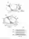 Fig. 02 - Lidded cell culture devices with improved handling performance and methods for using same