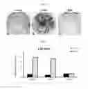 Fig. 07 - Methods for improving proliferation and stemness of limbal stem cells