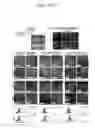 Fig. 08 - Methods for efficient derivation of human motor neurons from diverse spinal regions