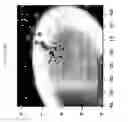Fig. 89 - METHODS AND NUCLEIC ACIDS FOR ANALYSES OF COLORECTAL CELL PROLIFERATIVE DISORDERS