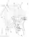 Fig. 02 - Truss assembly and method of constructing a truss structure