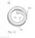 Fig. 14 - Wire thread insert with redress mounting tang as well as its manufacturing and installation