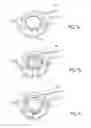 Fig. 02 - PERMANENT SCREW ATTACHMENT