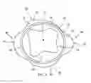 Fig. 04 - PISTON WITH VARIABLE DEPTH GROOVE ROOT