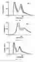 Fig. 07 - METHODS TO DETERMINE THE DISTRIBUTION PROFILES OF CIRCULATING MICRORNAS