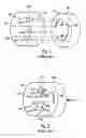 Fig. 02 - High-pressure control valve for high-performance liquid chromatography