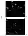 Fig. 09 - Devices, systems and methods for inhibiting invasion and metastases of cancer