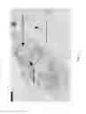 Fig. 02 - Immunohistochemistry scoring methods and compositions
