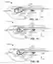 Fig. 07 - Display including a film lightguide bent around a guide element