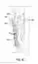 Fig. 06 - Single piece card retainer