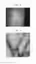 Fig. 08 - Device and method for biometrics authentication