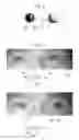 Fig. 06 - GAZE DETECTION APPARATUS AND GAZE DETECTION METHOD