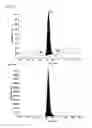 Fig. 07 - Methods of detecting reverse triiodothyronine by mass spectrometry