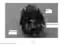 Fig. 02 - RING VARISTOR-BASED METHOD FOR REDUCING ELECTROMAGNETIC INTERFERENCE OF MOTOR