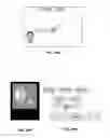 Fig. 16 - Intuitive computing methods and systems
