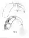 Fig. 02 - HEARING DEVICE COMPRISING MODULAR ENGAGEMENT MEANS