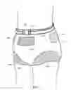 Fig. 04 - Slip-on Slip-over Hip Protector
